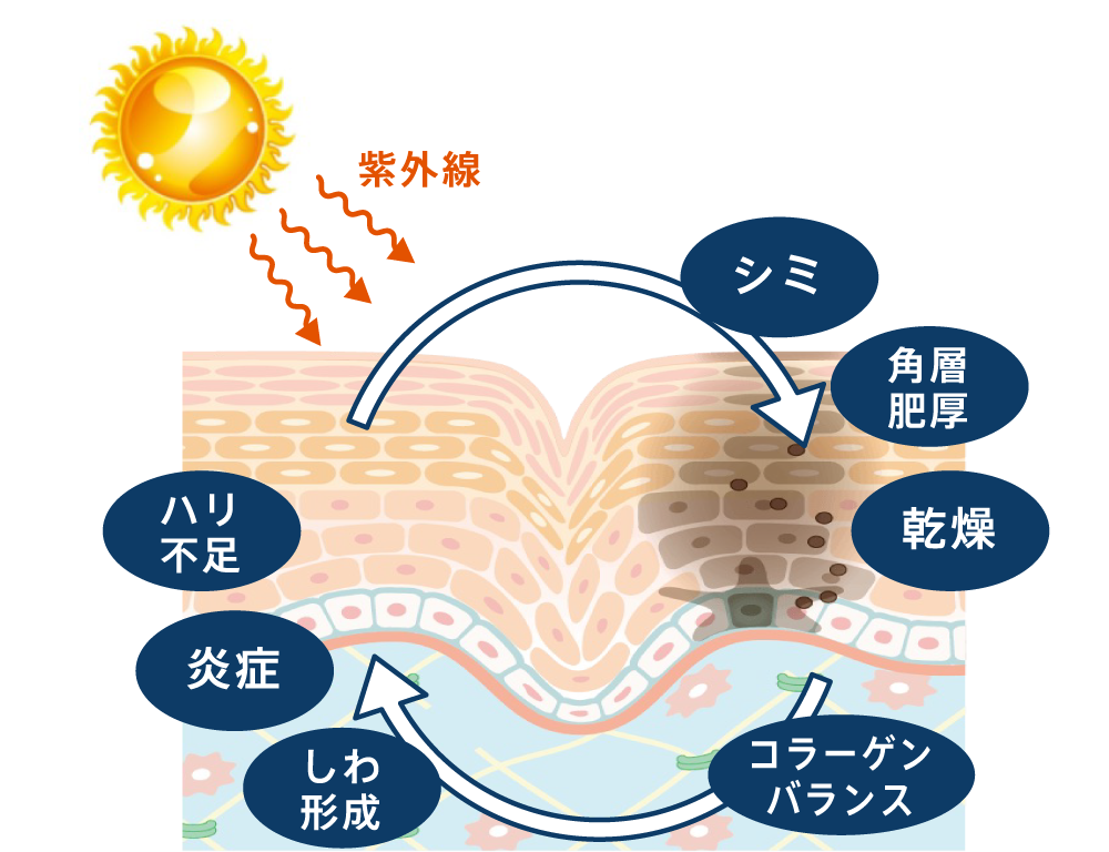 光ダメージ視点で肌深部の蓄積ダメージヘアプローチ